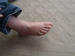 Twisted Ankle Top-After